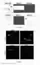 Fig. 10 - NOVEL ALTERNATIVE SPLICE TRANSCRIPTS FOR MHC CLASS I RELATED CHAIN ALPHA (MICA) AND USES THEREOF