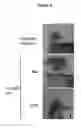 Fig. 05 - Thrombospondin-1 polypeptides and methods of using same