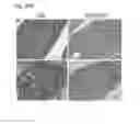 Fig. 47 - Methods of manipulating phagocytosis mediated by CD47