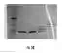 Fig. 12 - Methods and compositions related to single chain antibody fragments that bind to tumor-associated glycoprotein 72 (TAG-72)