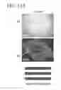 Fig. 19 - Photodegradable cross-linking agent, photodegradable gel, cell culture instrument, cell arrangement-sorting apparatus, cell arrangement method, cell sorting method, tissue forming method, and tissue