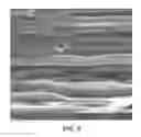 Fig. 07 - Flexible polymeric material with shape retention properties