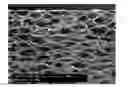 Fig. 01 - Foamed caps and closure seal comprising polyethylene foam