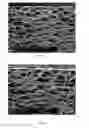 Fig. 02 - Foamed caps and closure seal comprising polyethylene foam