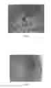Fig. 07 - Coated microcapsules