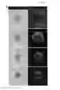 Fig. 12 - METHOD FOR INTEGRATING BIOLOGICAL TISSUES WITH A VASCULAR SYSTEM
