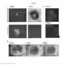 Fig. 26 - METHOD FOR INTEGRATING BIOLOGICAL TISSUES WITH A VASCULAR SYSTEM
