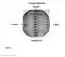 Fig. 03 - Heterologous expression of termite cellulases in yeast