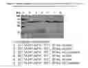 Fig. 08 - CELL-TARGETED MOLECULES COMPRISING AMINO-TERMINUS PROXIMAL OR AMINO-TERMINAL SHIGA TOXIN A SUBUNIT EFFECTOR REGIONS