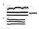 Fig. 06 - Channel modulators