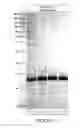 Fig. 11 - Compositions and methods using capsids resistant to hydrolases