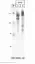 Fig. 18 - Compositions and methods using capsids resistant to hydrolases