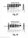 Fig. 16 - Antisense molecules and methods for treating pathologies