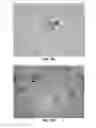 Fig. 22 - Methods and Compositions for the Treatment of Prostate Related Disorders using miR-106b