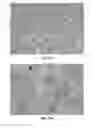 Fig. 25 - Methods and Compositions for the Treatment of Prostate Related Disorders using miR-106b