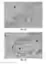 Fig. 26 - Methods and Compositions for the Treatment of Prostate Related Disorders using miR-106b
