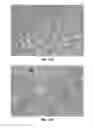 Fig. 25 - Methods and Compositions for the Treatment of Prostate Related Disorders using miR-32