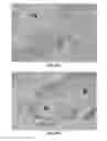Fig. 26 - Methods and Compositions for the Treatment of Prostate Related Disorders using miR-32