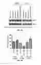 Fig. 04 - Methods and Compositions for Increasing the Efficacy of Doxorubicin Treatment in the Treatmentof Prostate Related Disorders using miR-106b-25 Cluster