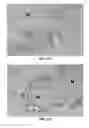 Fig. 26 - Methods and Compositions for Increasing the Efficacy of Doxorubicin Treatment in the Treatmentof Prostate Related Disorders using miR-106b-25 Cluster