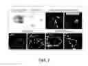 Fig. 08 - Method for production of reprogrammed cell using chromosomally unintegrated virus vector