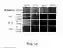 Fig. 13 - Method for production of reprogrammed cell using chromosomally unintegrated virus vector