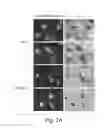 Fig. 05 - FUS/TLS-based compounds and methods for diagnosis, treatment and prevention of amyotrophic lateral sclerosis and related motor neuron diseases