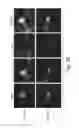 Fig. 06 - FUS/TLS-based compounds and methods for diagnosis, treatment and prevention of amyotrophic lateral sclerosis and related motor neuron diseases