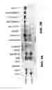 Fig. 04 - LAFORA'S DISEASE GENE