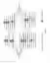 Fig. 09 - Esophageal microRNA expression profiles in eosinophilic esophagitis
