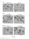 Fig. 25 - Esophageal microRNA expression profiles in eosinophilic esophagitis