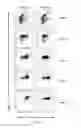 Fig. 30 - Esophageal microRNA expression profiles in eosinophilic esophagitis