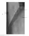 Fig. 03 - Pad for support of equipment and method of producing same