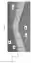Fig. 05 - Pad for support of equipment and method of producing same