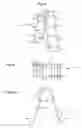 Fig. 02 - Concrete depression form system and method