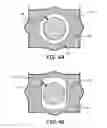 Fig. 06 - Pinned seal