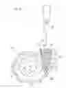 Fig. 05 - SUPERCHARGER FOR ENGINE