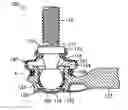 Fig. 01 - Ball joint