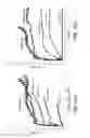 Fig. 04 - Rate responsive, stretchable devices further improvements