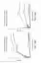 Fig. 21 - Rate responsive, stretchable devices further improvements