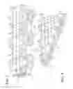 Fig. 06 - Multilayer static gasket, distance layer with improved stopper region therefor, and method of construction thereof