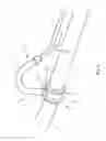 Fig. 02 - Pipe assembly comprising a draining system
