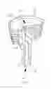 Fig. 03 - Plastic lamp base with zigzag electrical conductor and light bulb using the same