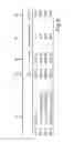 Fig. 10 - Light module and method for providing wavelength-converted light in the red spectral range and projection device therefor