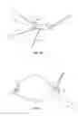 Fig. 05 - HOIST DEVICE WITH SHOOTING AID