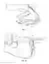 Fig. 07 - HOIST DEVICE WITH SHOOTING AID