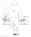 Fig. 12 - Retractable measuring and cutting device