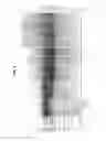 Fig. 05 - MICROFLUIDIC TRANSDUCER