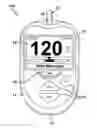 Fig. 01 - SYSTEM AND METHOD FOR ANALYTE MEASUREMENT