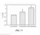 Fig. 09 - Single-walled carbon nanotube biosensor for detection of glucose, lactate, and urea